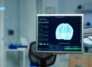 China autoriza implante cerebral pioneiro para reabilitação de tetraplegia