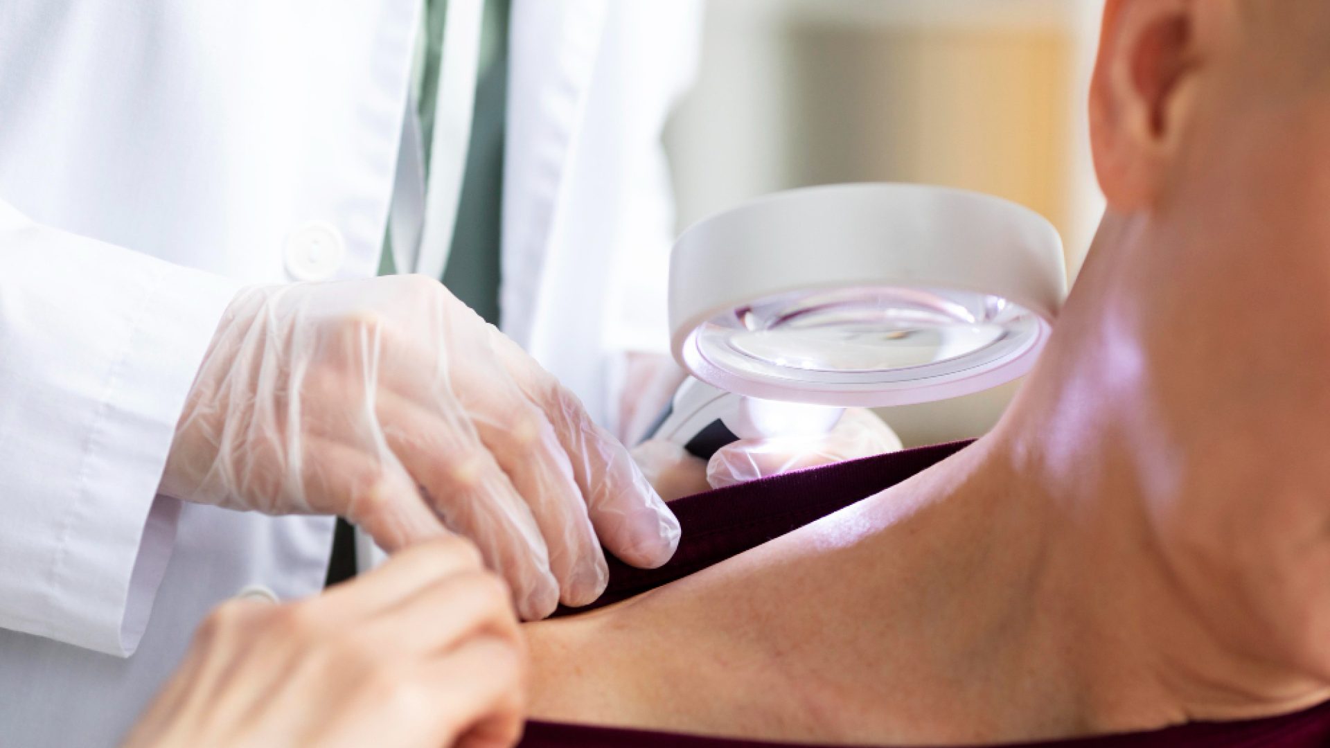 Vacina personalizada contra melanoma avança em testes e reduz risco de retorno do câncer